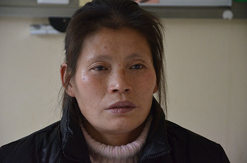 左眼几近致盲 角膜病患者普瑞重见光明