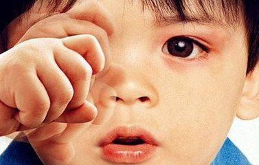 孩子弱视6岁前视力能够提升