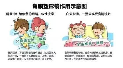 更轻、更薄、更安全！全新CRT角膜塑形镜让控制近视更简单
