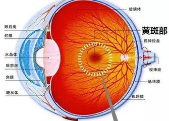 黄斑变性是怎么回事？黄斑变性的方法？