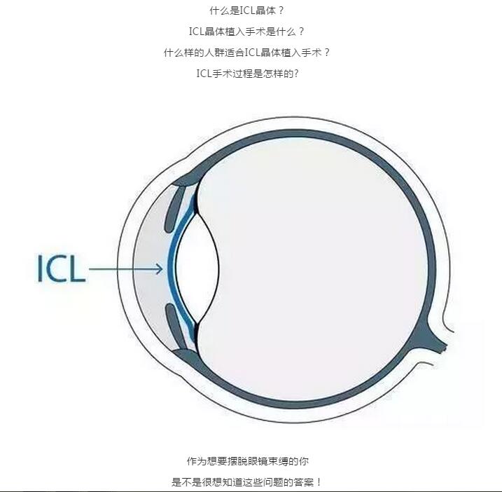 甘肃交通广播女主播艾静在我院体验瑞士黑科技—ICL